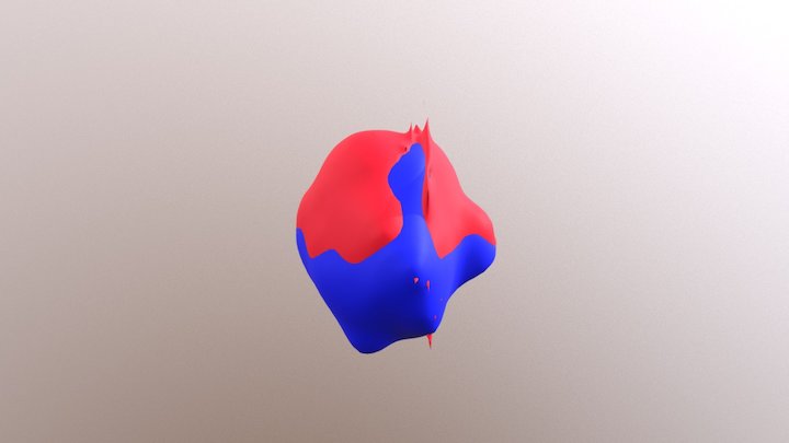 Tumor 3D Model