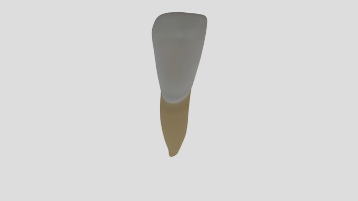 Mandibular Lateral Incisor (Right)