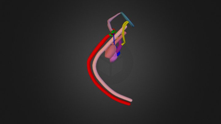 LAA R Retroesoph RSCA Divert of Kommerell stg 3 3D Model