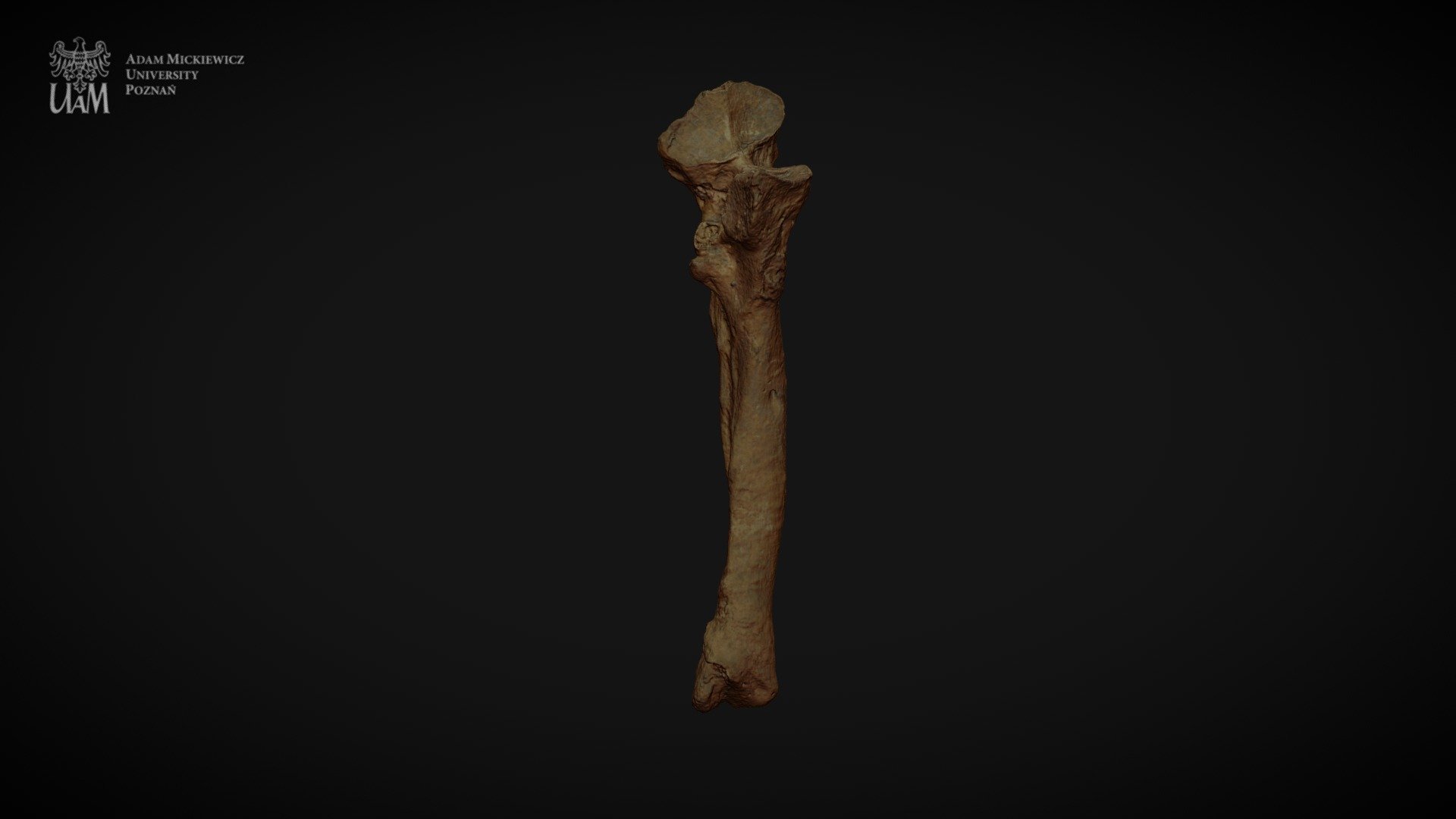 Achondroplastic dwarf - right ulna - 3D model by AMU Human Evolutionary ...