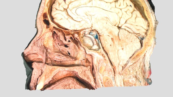 Res Corner Sagital Sinus and nasopharynx 3D Model