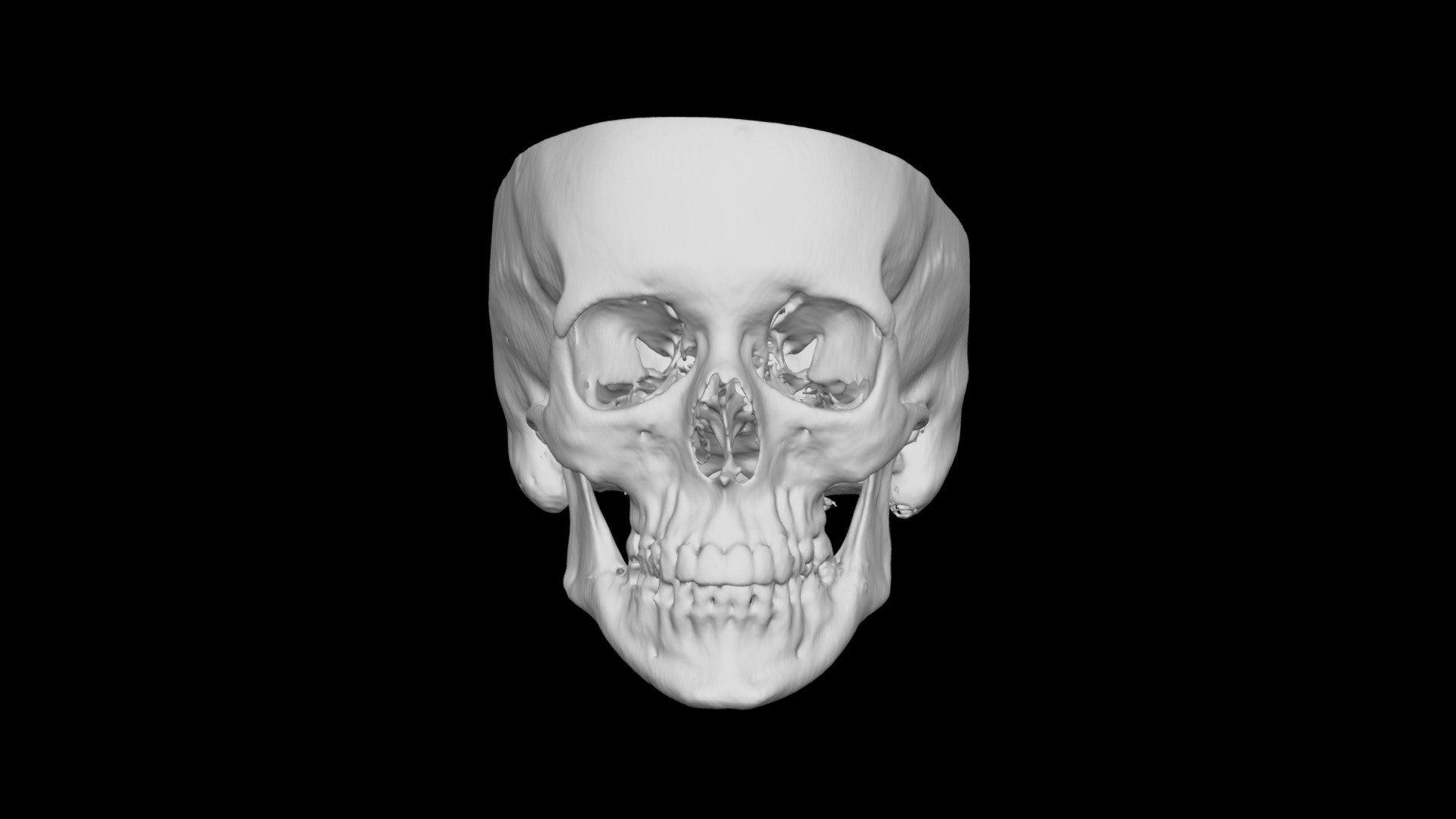 Skull Female 44yo
