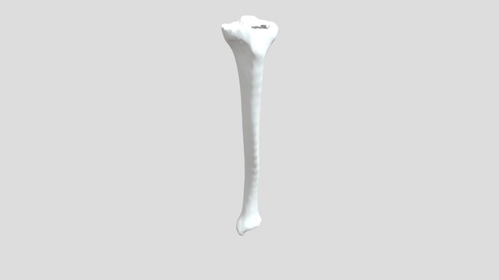 Tibia