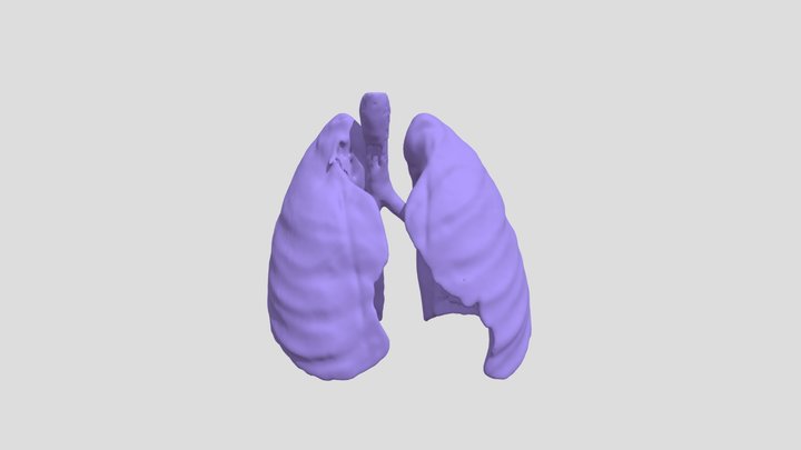Segmentation_lungs 3D Model