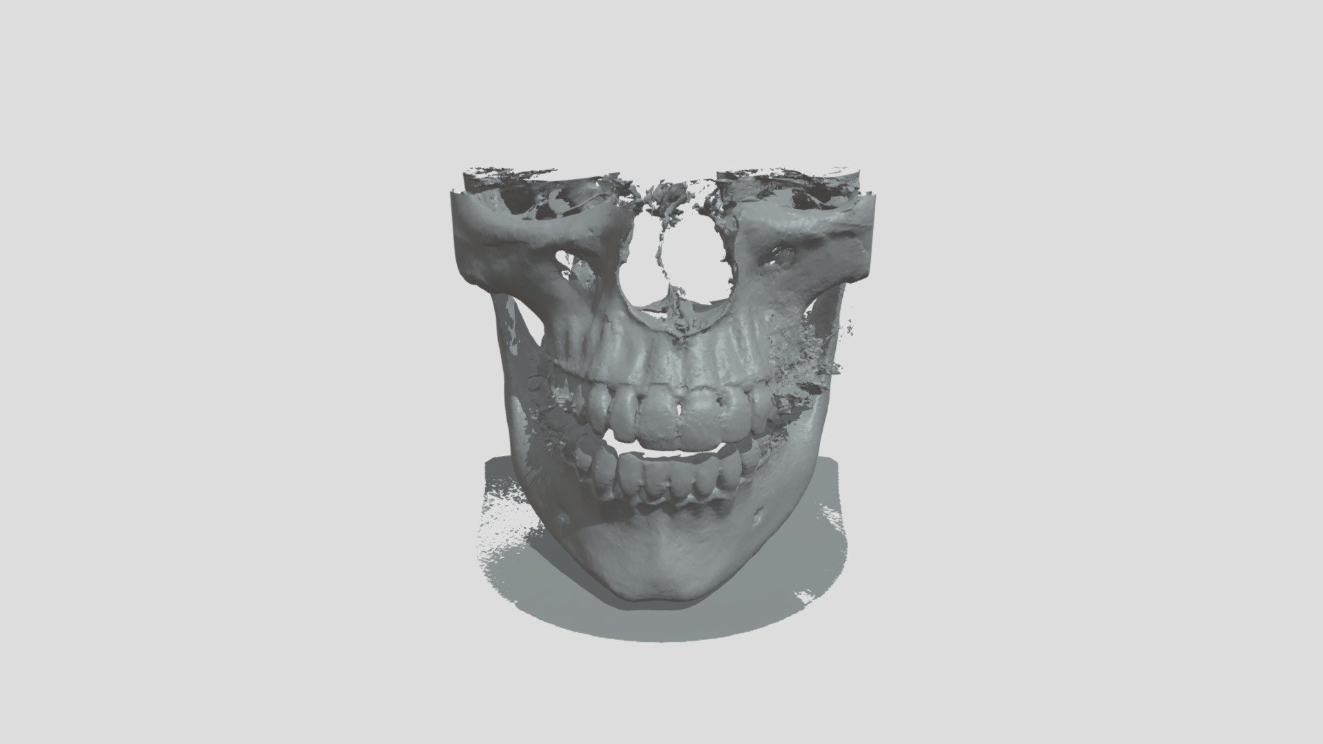 Chrome skull