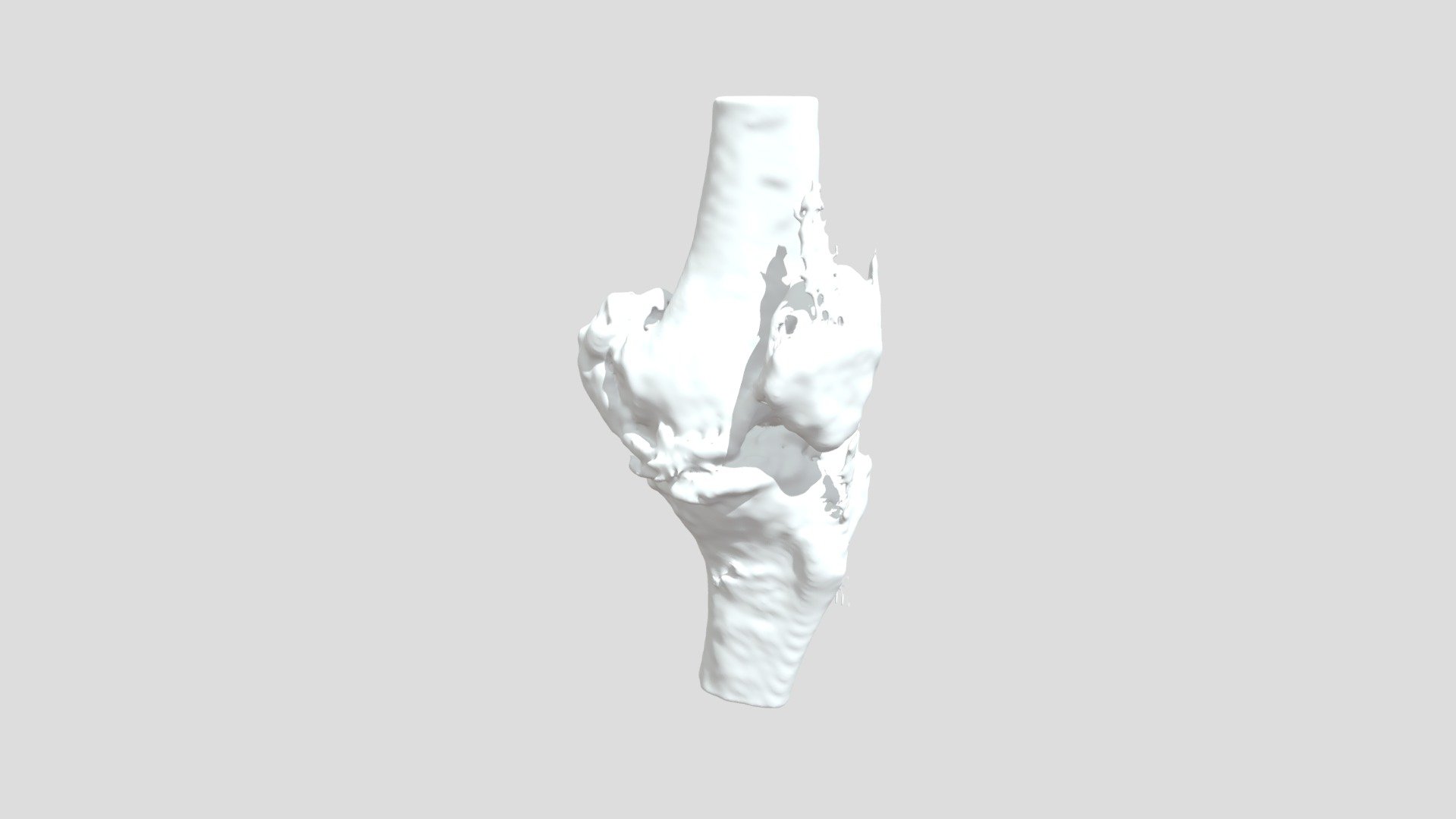 Segmentation Ltbonerk