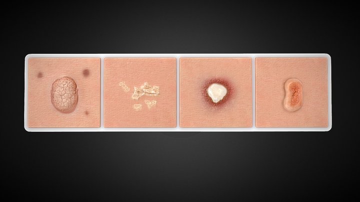 TIRA LESIONES - TEXTURA 3D Model