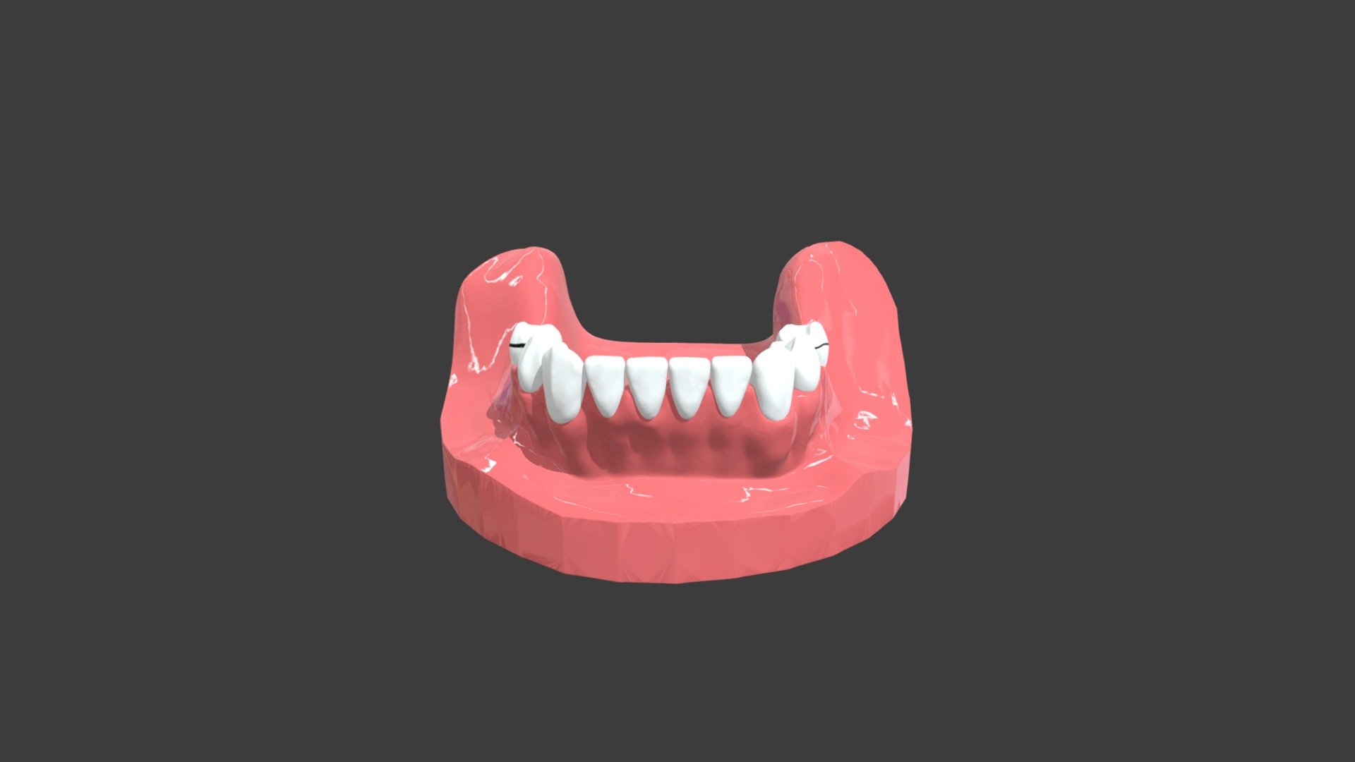 Mandibular RPD Arch - 3D model by Ahmed Mahrous (@drahedmahrous ...