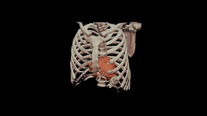 Overall view 3D Model