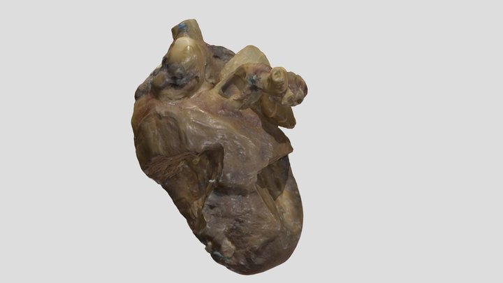 Transposition of Great Arteries_A7861 3D Model
