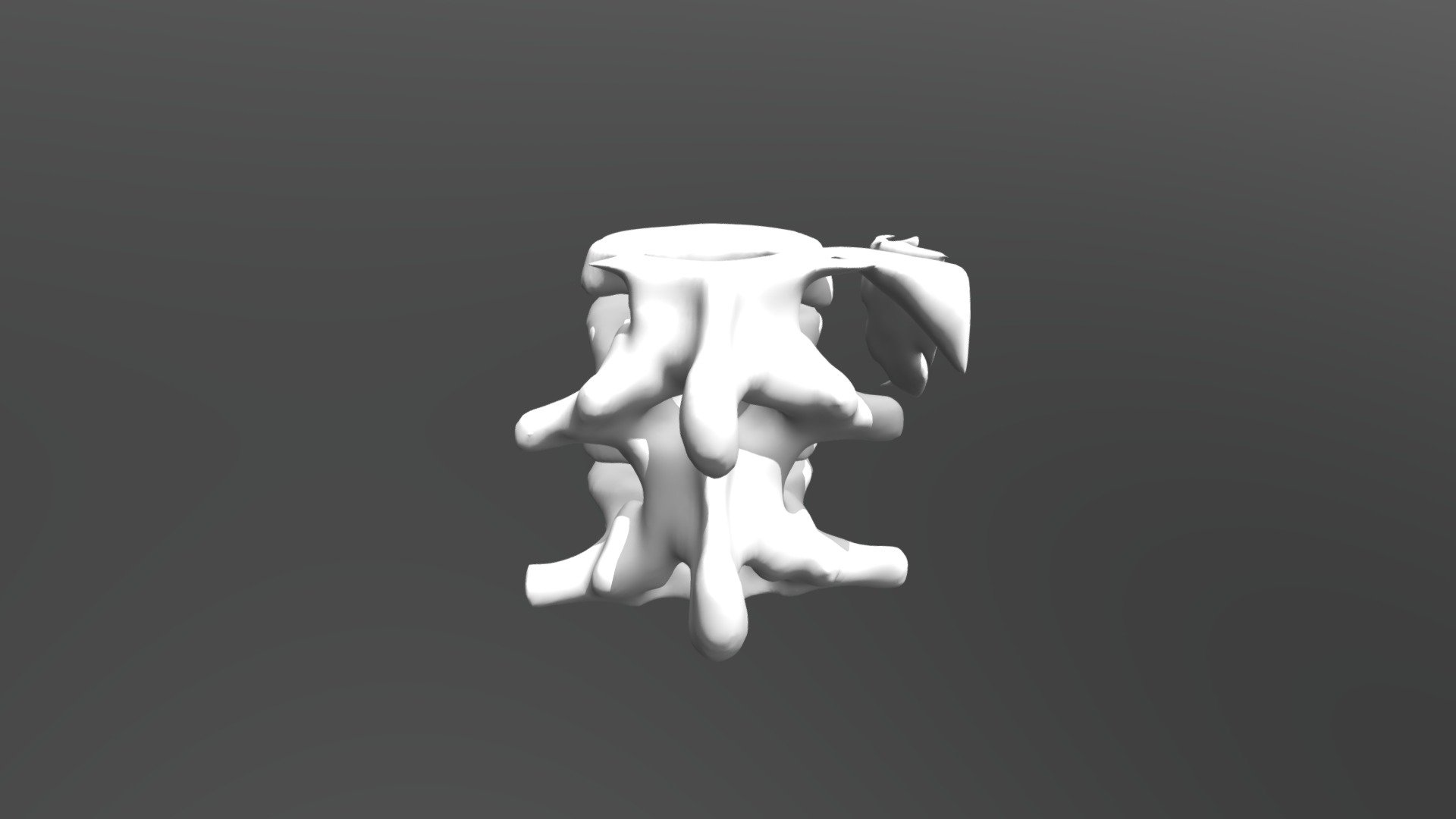 Bone