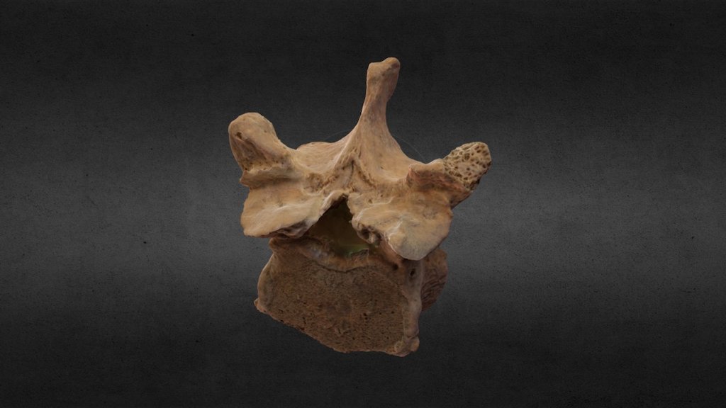 Human Vertebra v1.0
