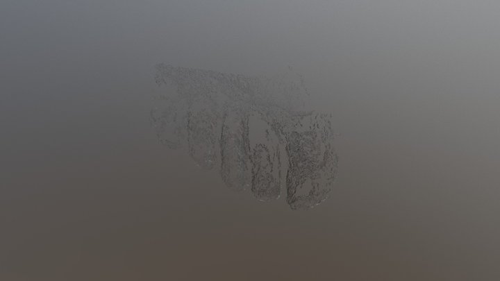 Diabetic foot point cloud 3D Model