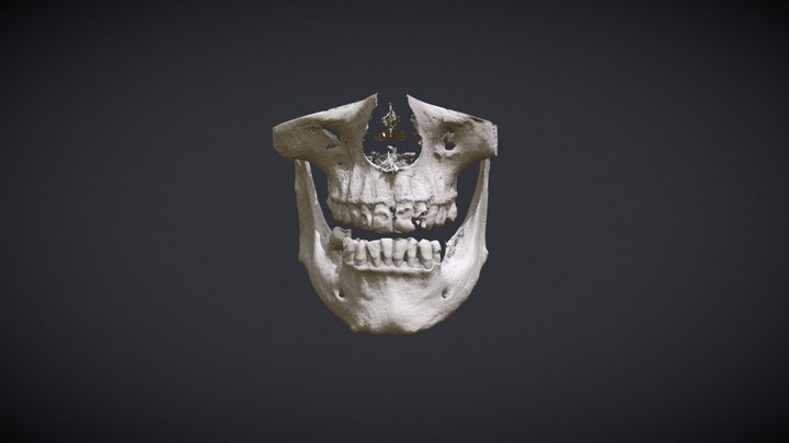 Teeth01 3D Model