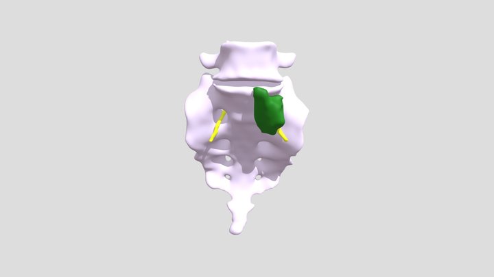 sacrotumornervio 3D Model