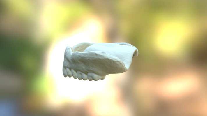 Denture
