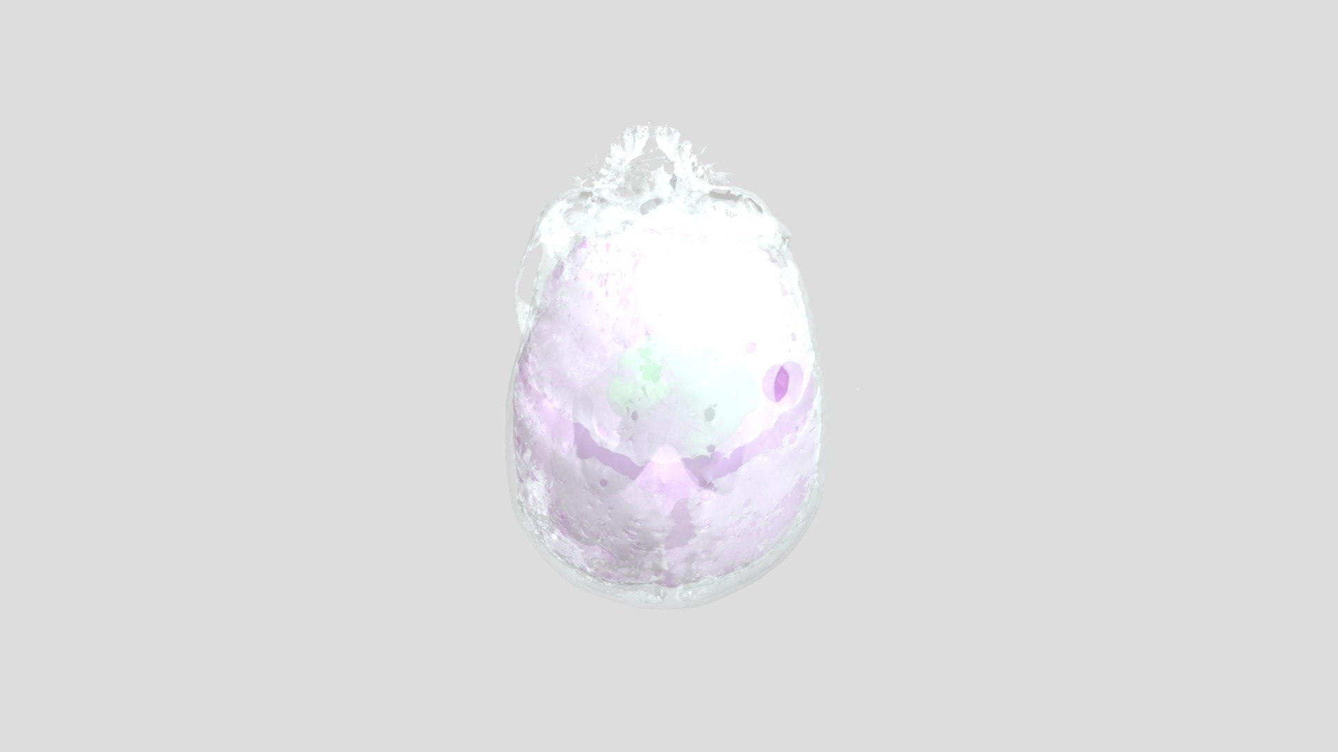 Segmentation