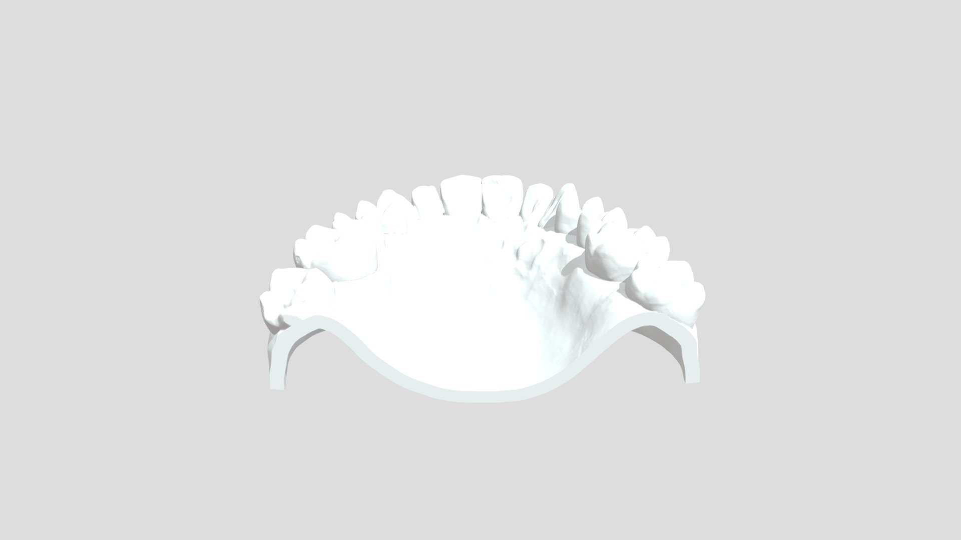 Dentures by 3DMakerPro Whale - Download Free 3D model by adamwang ...