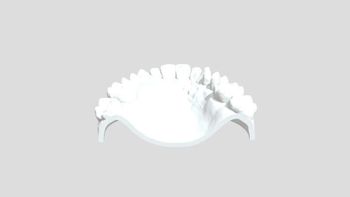 Dentures by 3DMakerPro Whale 3D Model