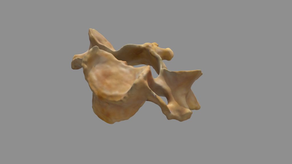 Cervical vertebra (Toucan + Turntable)