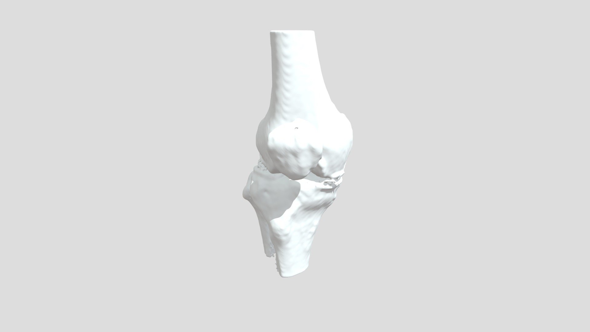 Segmentation Vbrtbone