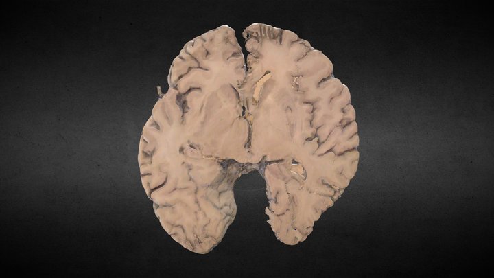 Transversal brain section 3D Model
