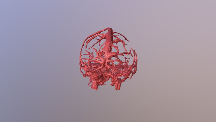 BrainVessel 3D Model