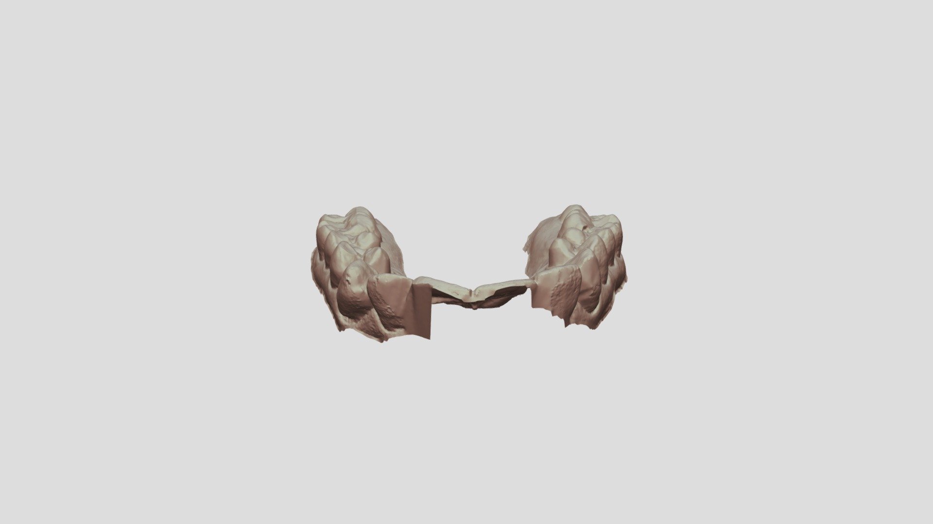 Kinnera k 5D printing - 3D model by mulberrydental [2758aaf] - Sketchfab