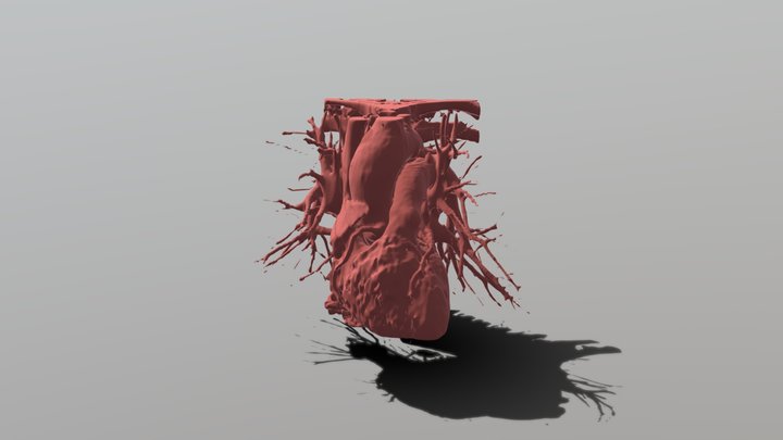 Blood Flow during Systole 3D Model