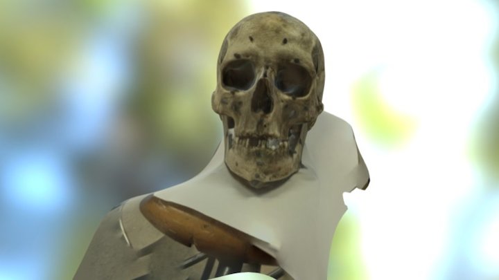 TRNIO Model