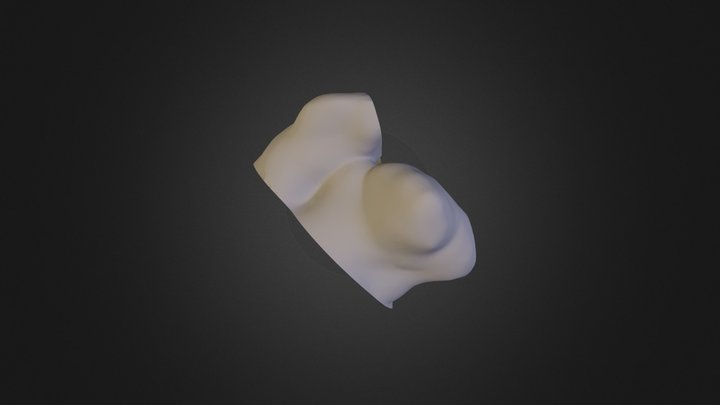 Left Atrial Appendage 3D Model