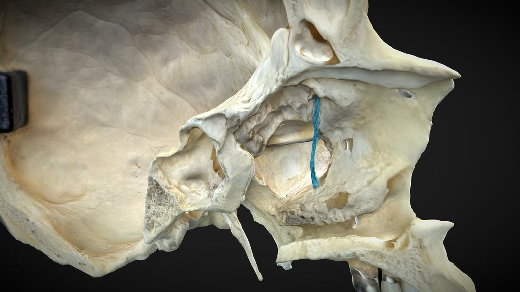 Bones of the Neurocranium - A 3D model collection by cfellmann - Sketchfab
