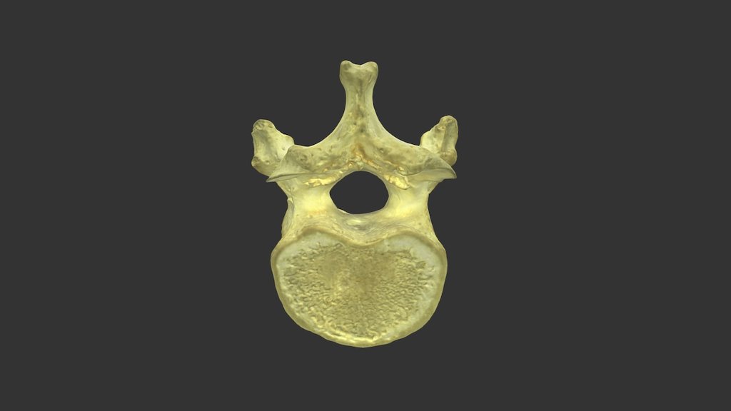 Thoracic Vertebra with Texture - 3D model by Wellesley College ...