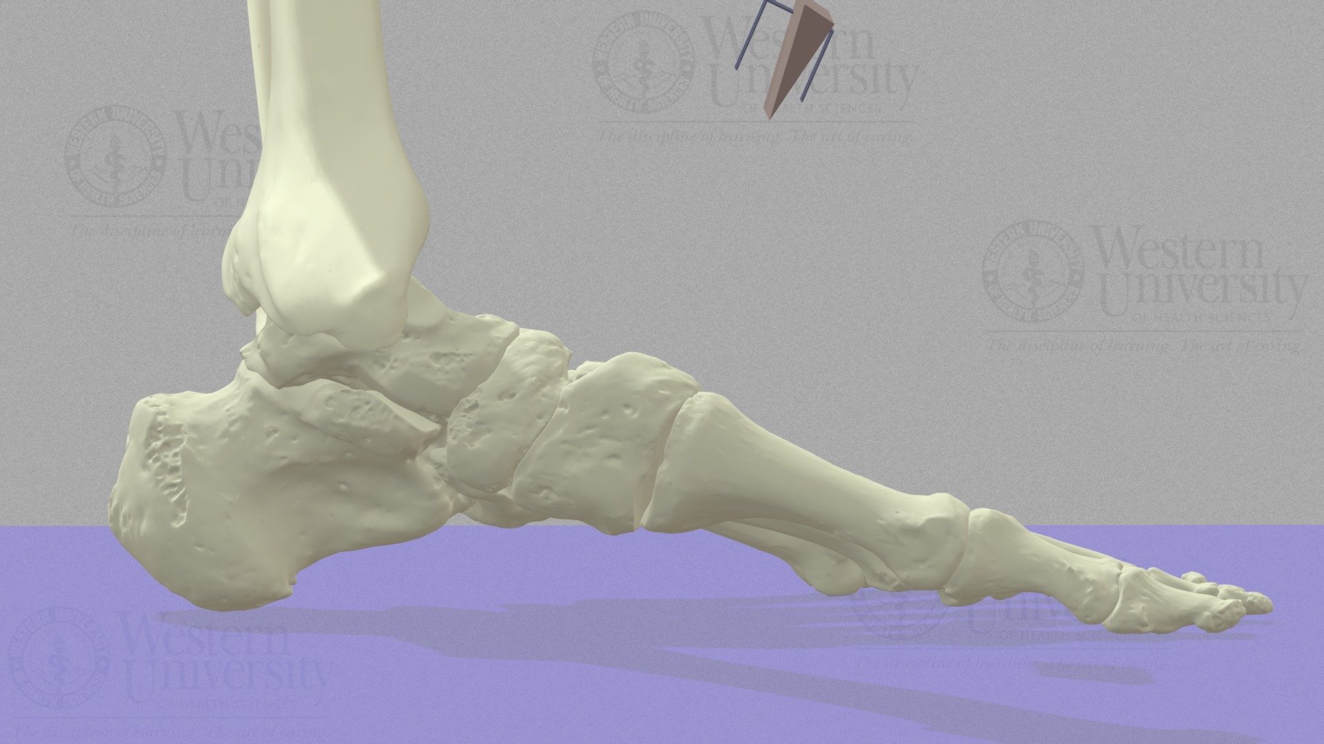 Cotton Osteotomy of the Cuneiform - - 3D model by WesternU3D [286d539 ...