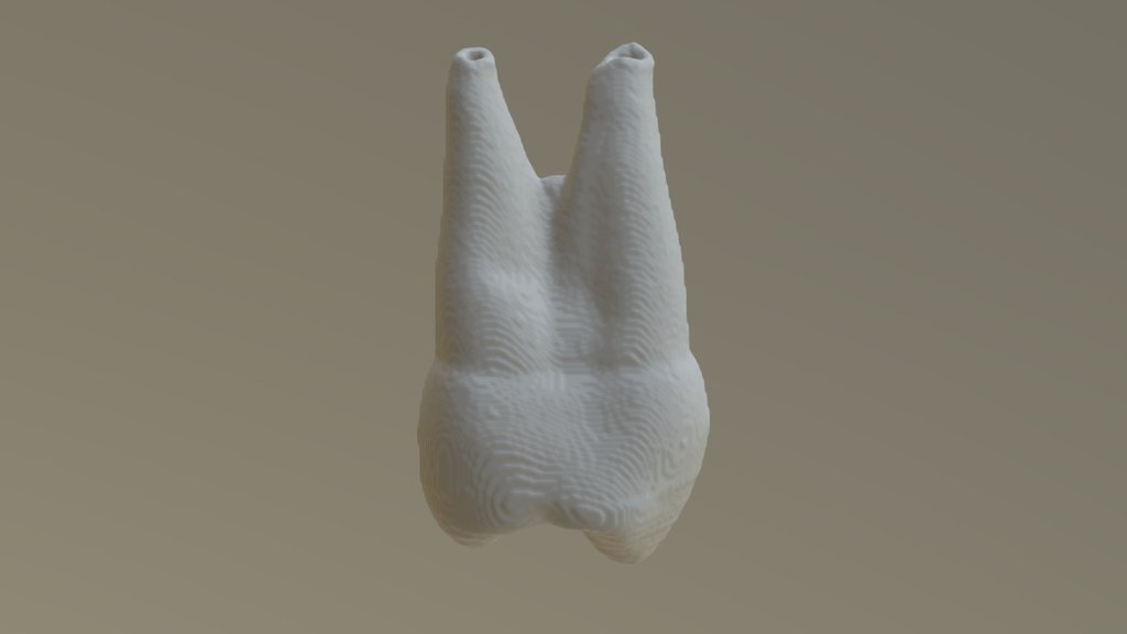 Pieza 1.4