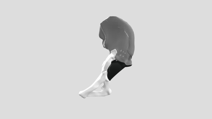 Beckenteilersatz aus dem 3D Titan Drucker 3D Model