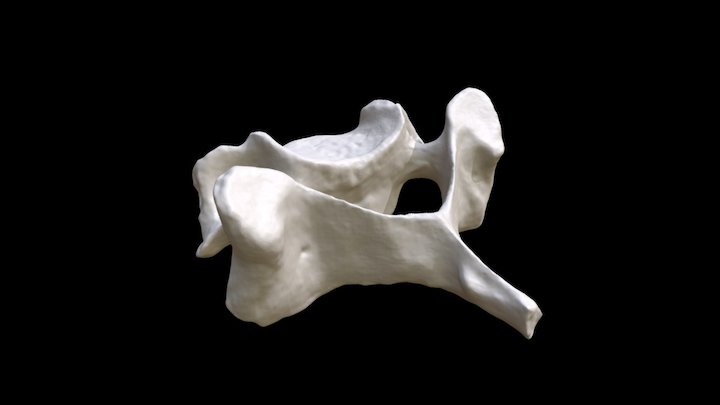 Human Cervical Vertebra (C3 or C4) – Free 3D Model STL