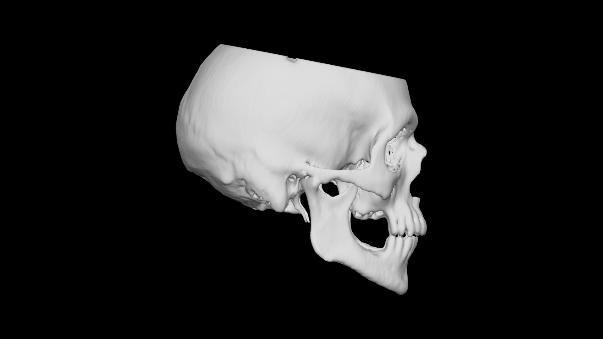 Skull Male 60yo