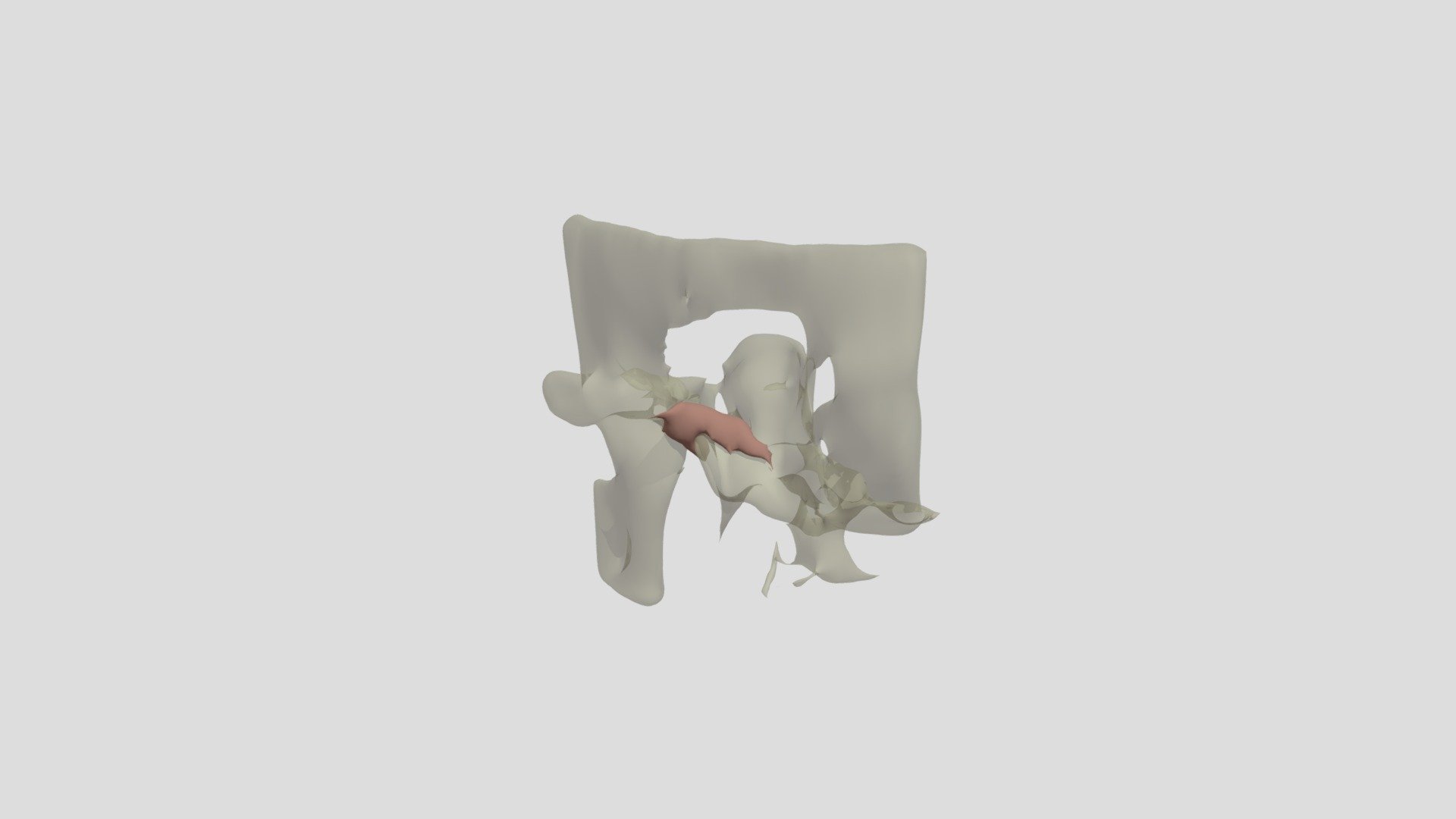 SPECT_CT_2020_06 - 3D model by viv555 [29ccf1e] - Sketchfab