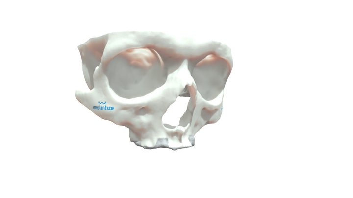Pedido 5638 - Implantize Maxila Total 3D Model