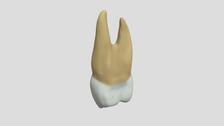 Maxillary First Premolar (Right)