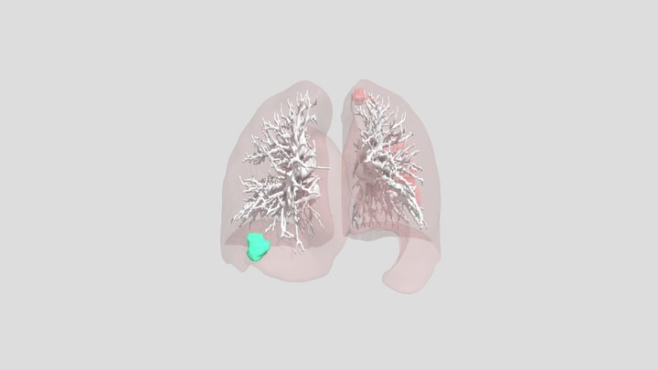 Case422_ai_set1 3D Model
