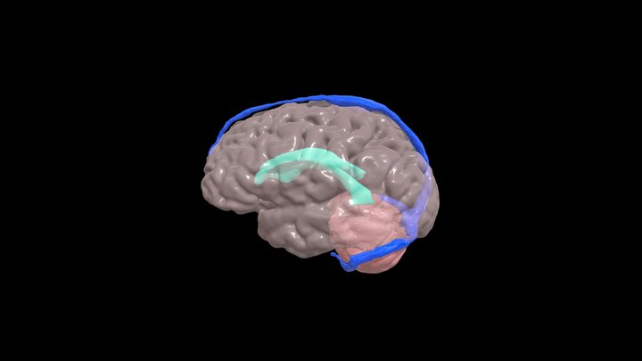 3DSlicer - MRI Brain Model 3D Model