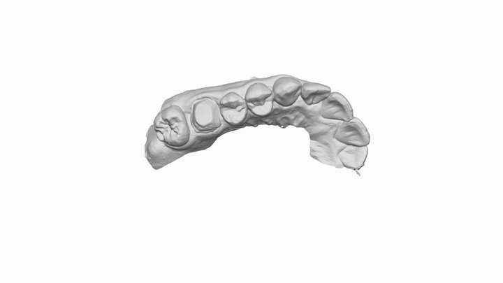 Example Jaw Data Input 3D Model