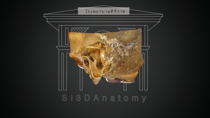Ear Anatomy (Mastoidectomy) 3D Model