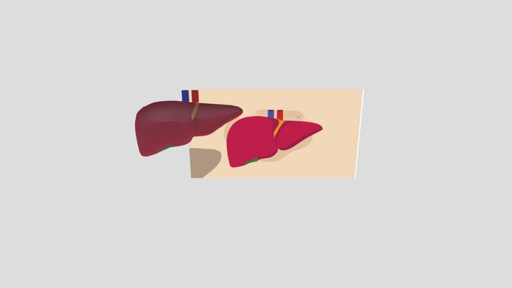 liver 3D Model