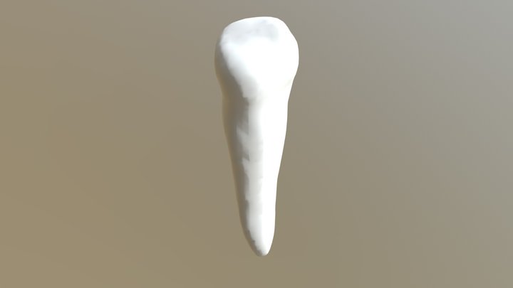Tooth 11 Upper 2 3D Model