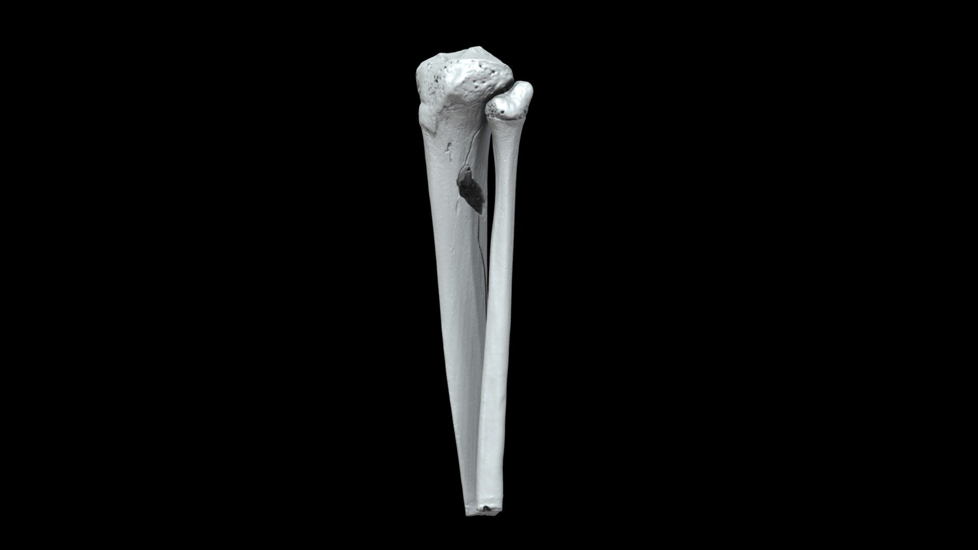 Tibia/Fibula BFT (VCU_3D_6772) - 3D model by Virtual Curation Lab ...