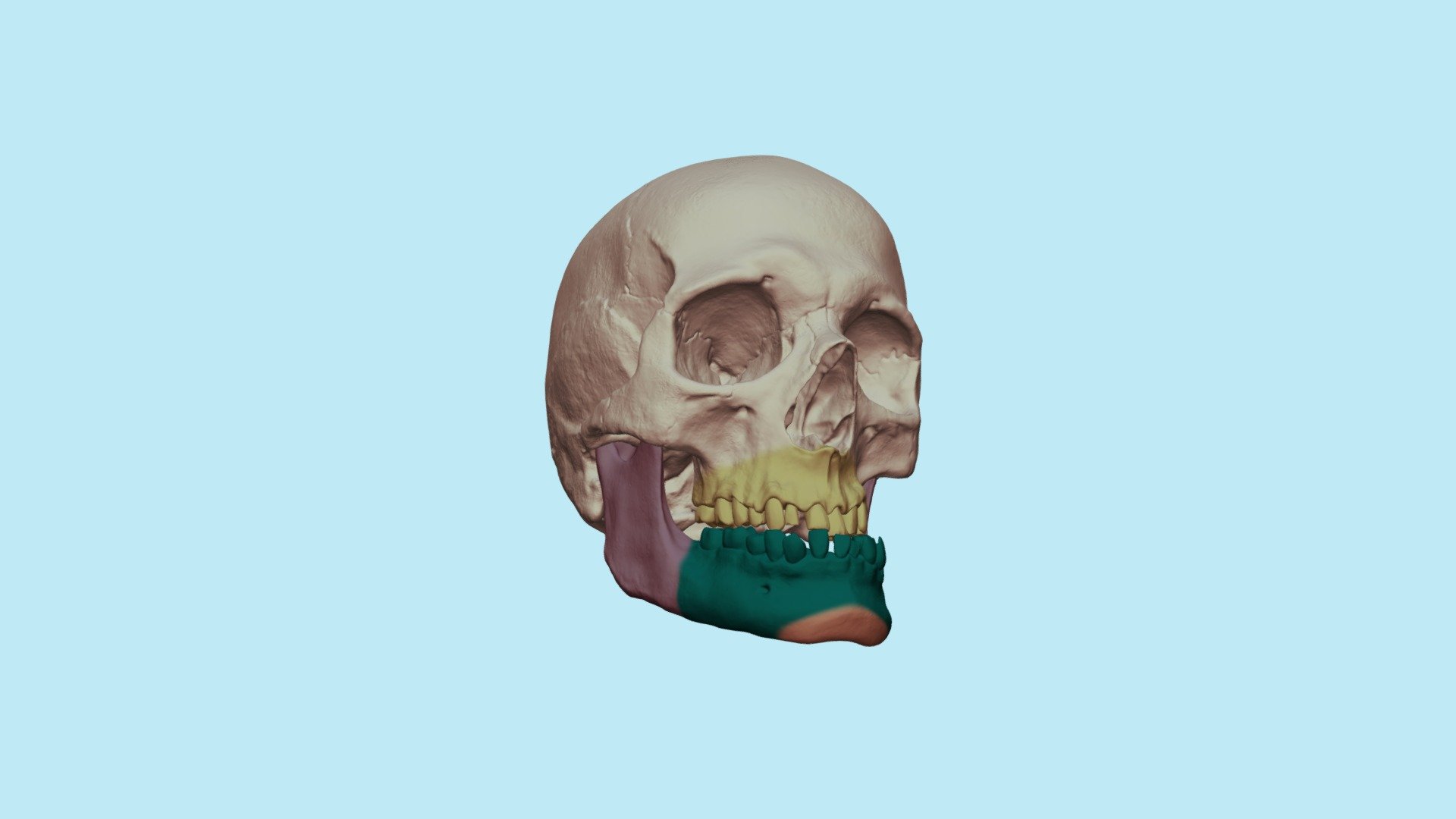 Асимметрия челюсти - 3D model by Dentell [2b4058a] - Sketchfab