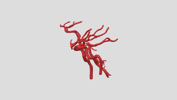 Cerebral Arterial Circle 3D Model
